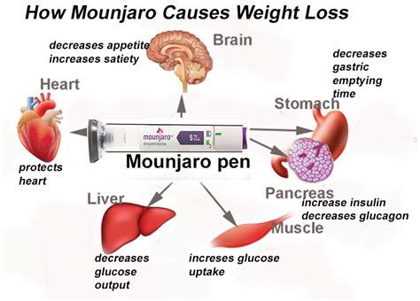 Almost all of the common <b>side</b> <b>effects</b> are GI related. . Mounjaro weight loss side effects